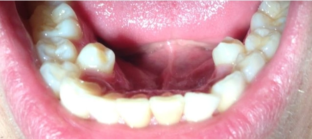 Top 10 People With Extra Body Parts