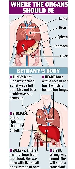 Top 10 People With Extra Body Parts